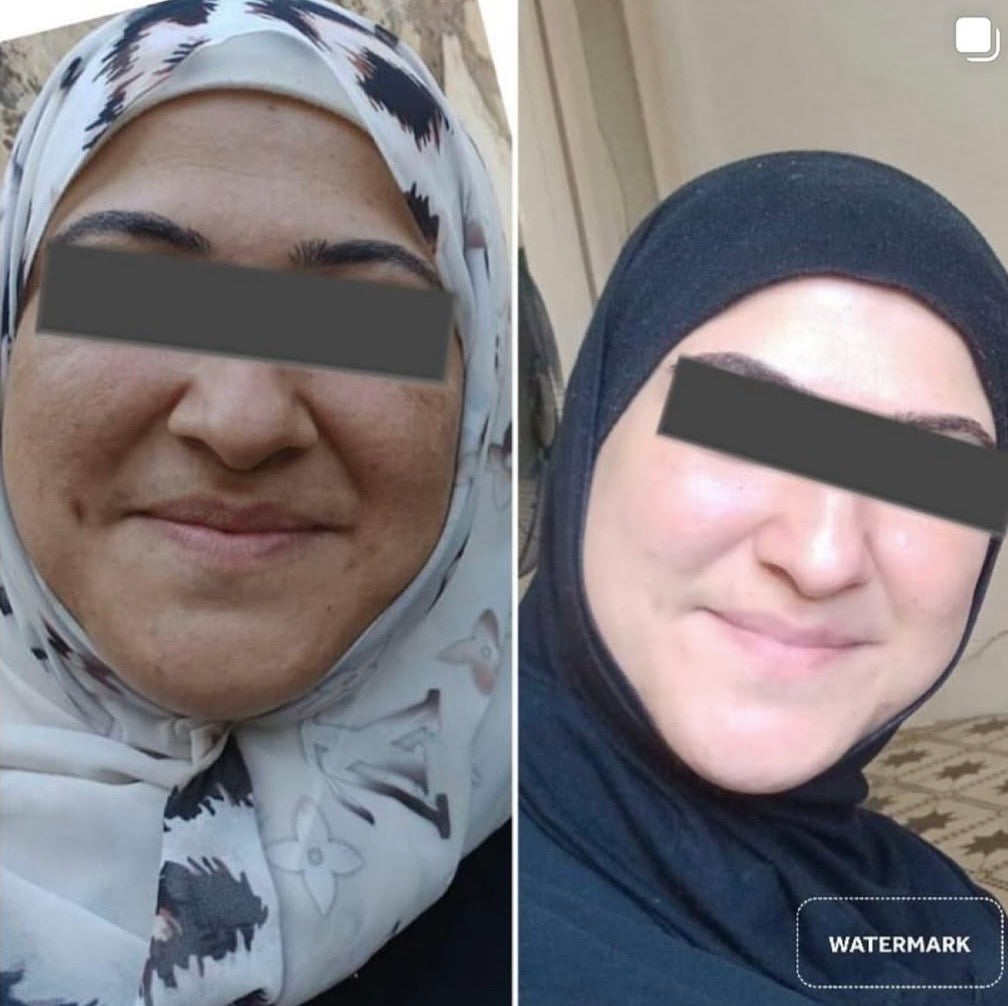 Collagen ampoule 7,500 mg, امبولات الكولاجين البحري