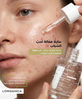 Acne serum, سيروم حب الشباب