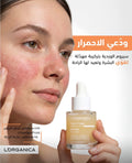 Rosicia serum, سيروم الخدود الحمراء