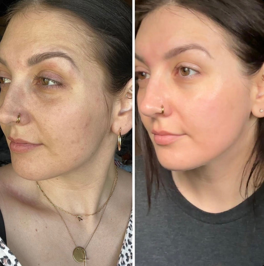 Collagen ampoule 7,500 mg, امبولات الكولاجين البحري