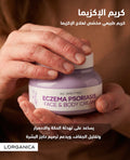 Eczema cream, كريم الاكزيما
