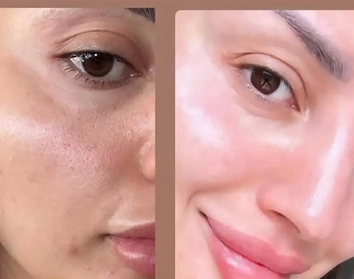 Collagen ampoule 6,000 mg, امبولات الكولاجين البحري