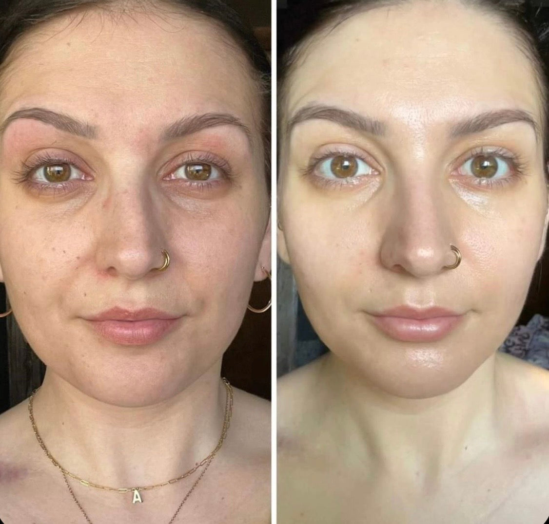 Collagen ampoule 7,500 mg, امبولات الكولاجين البحري