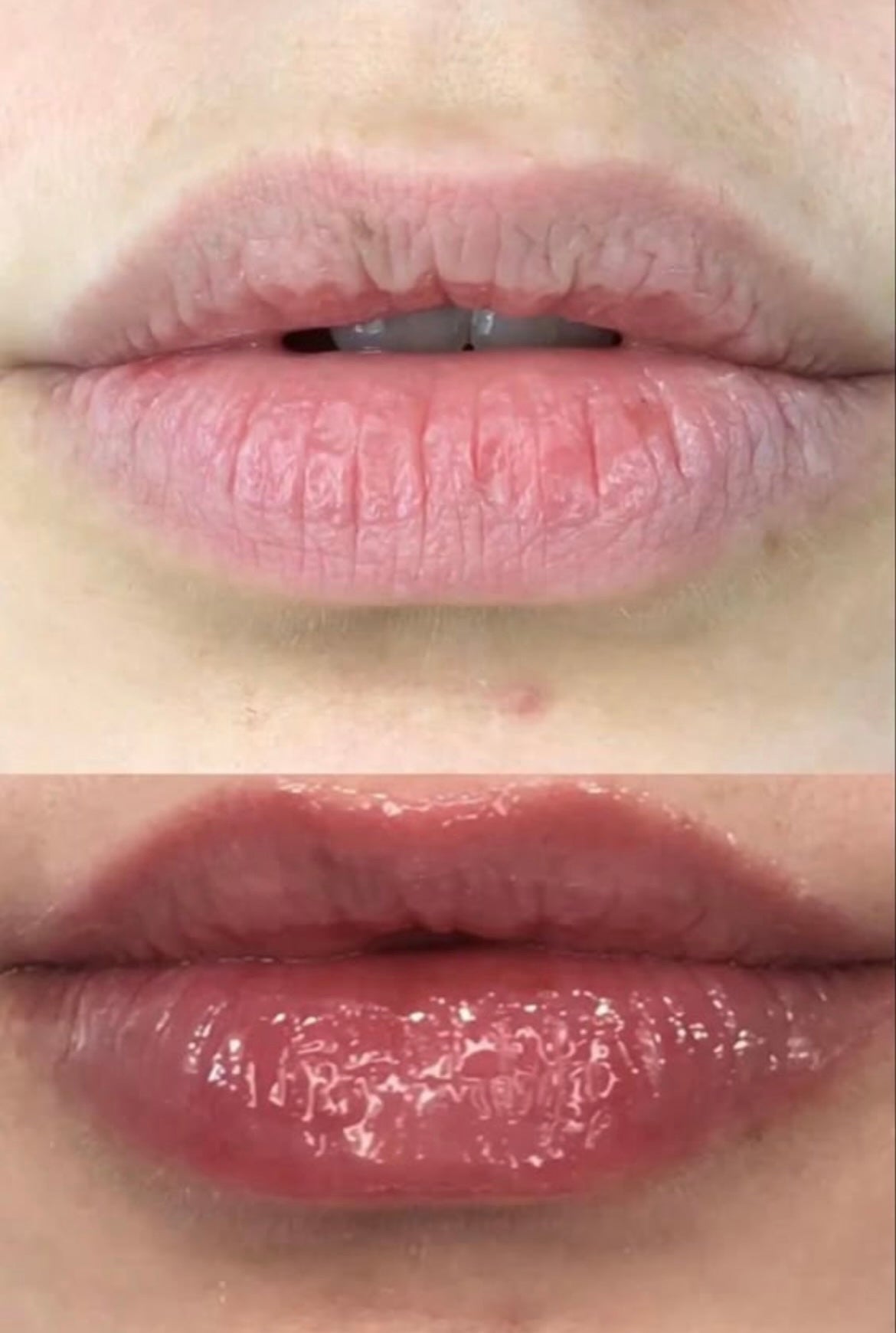 شفاه اكثر امتلاءً& زيت التكبير مع سكراب